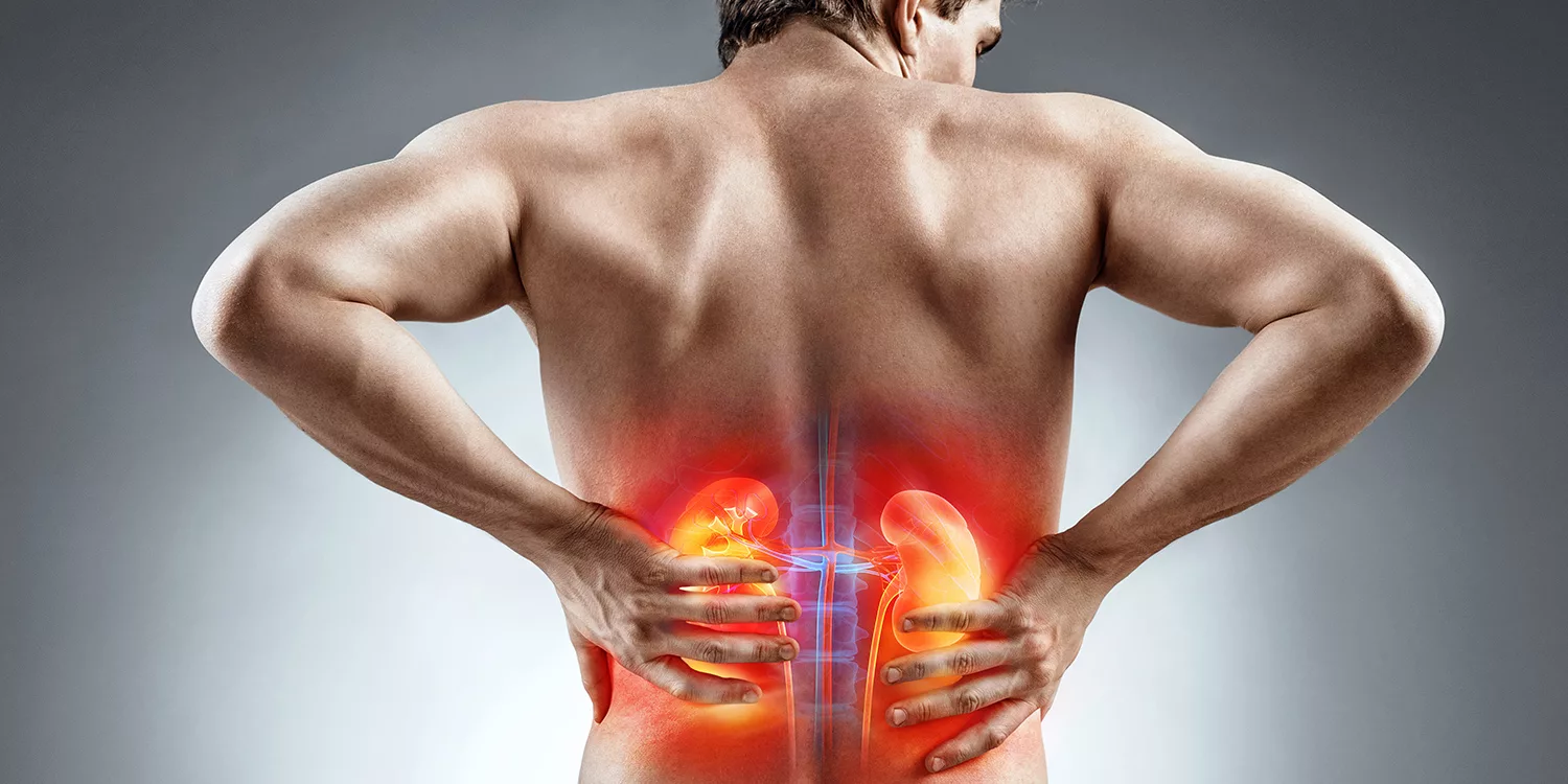 Kidney Stones Symptoms – Severe Back Pain Warning Signs