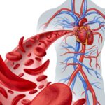 Sickle Cell Anemia Symptoms – Painful Crisis Episodes Explained Simply